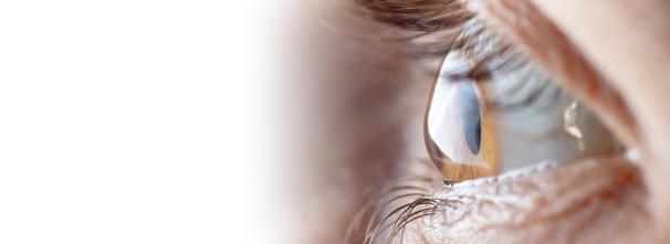 Hornhaut-Erkrankungen, Augenarzt Linz und Wien, Dirisamer Luft Priglinger