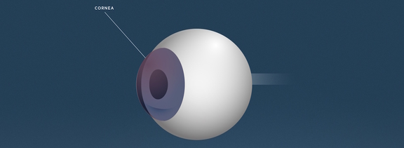 Trockenes Auge, Augenärzte Linz, Dirisamer Luft Priglinger