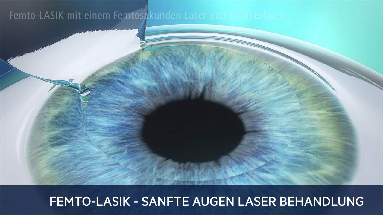Femto-LASIK, Augenärzte Linz, Dirisamer Luft Priglinger